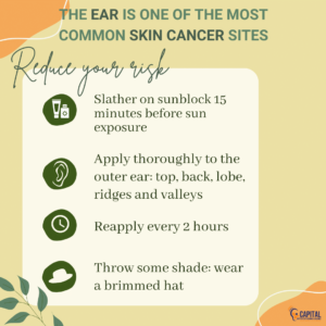 Tips to protect your ears from the sun