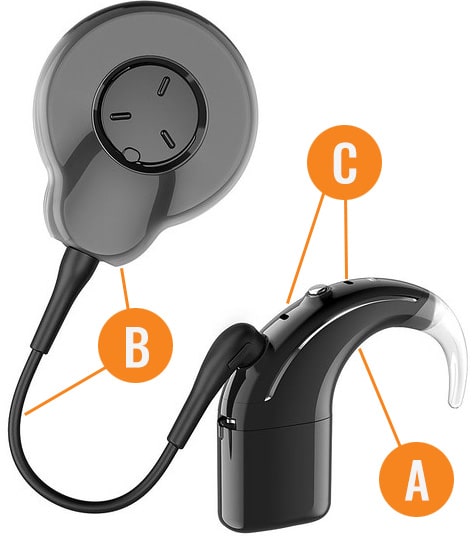 Cochlear external components