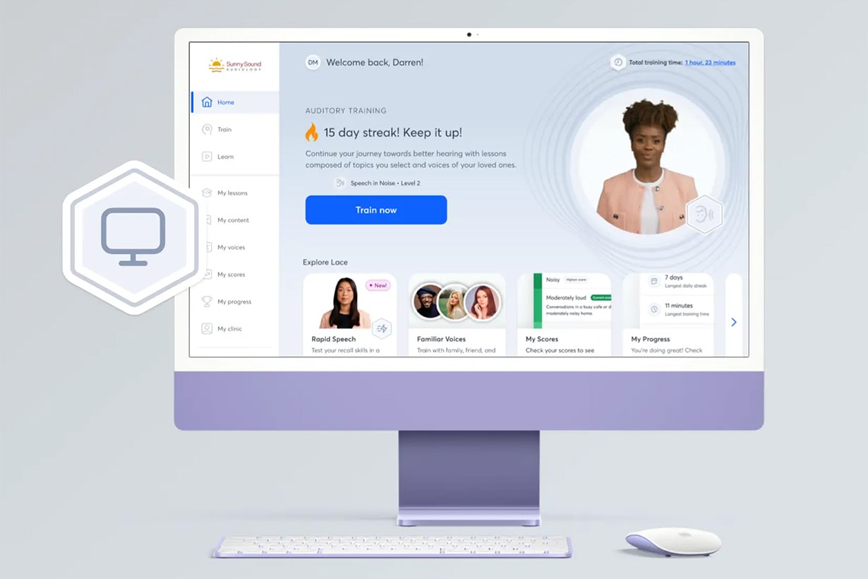 Cochlear implant quality of life