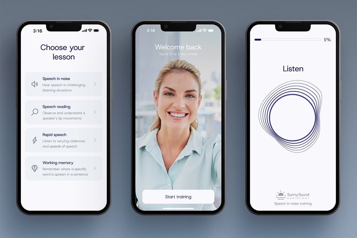 Cochlear implant benefits music